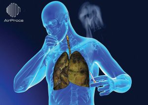 Dị ứng, hô hấp